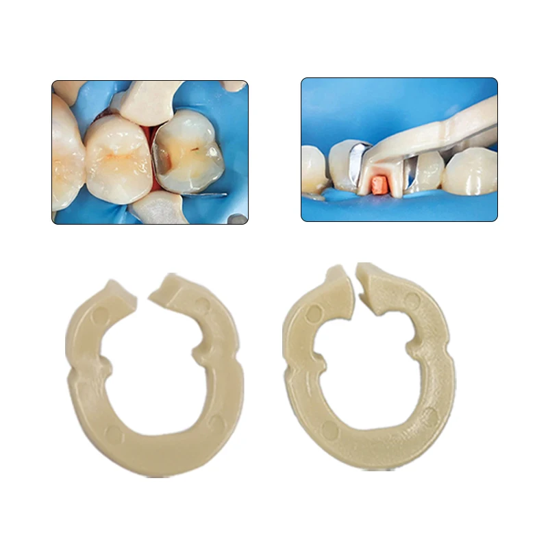 Resina dental anel de fixação separador anel secional contornado metal matrizes titular matriz braçadeira fixa autoclavable