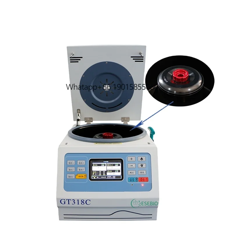 

ESEBIO 18000rpm CE Certified High Quality Desktop Laboratory Medical Centrifuge for Hospitals Clinics