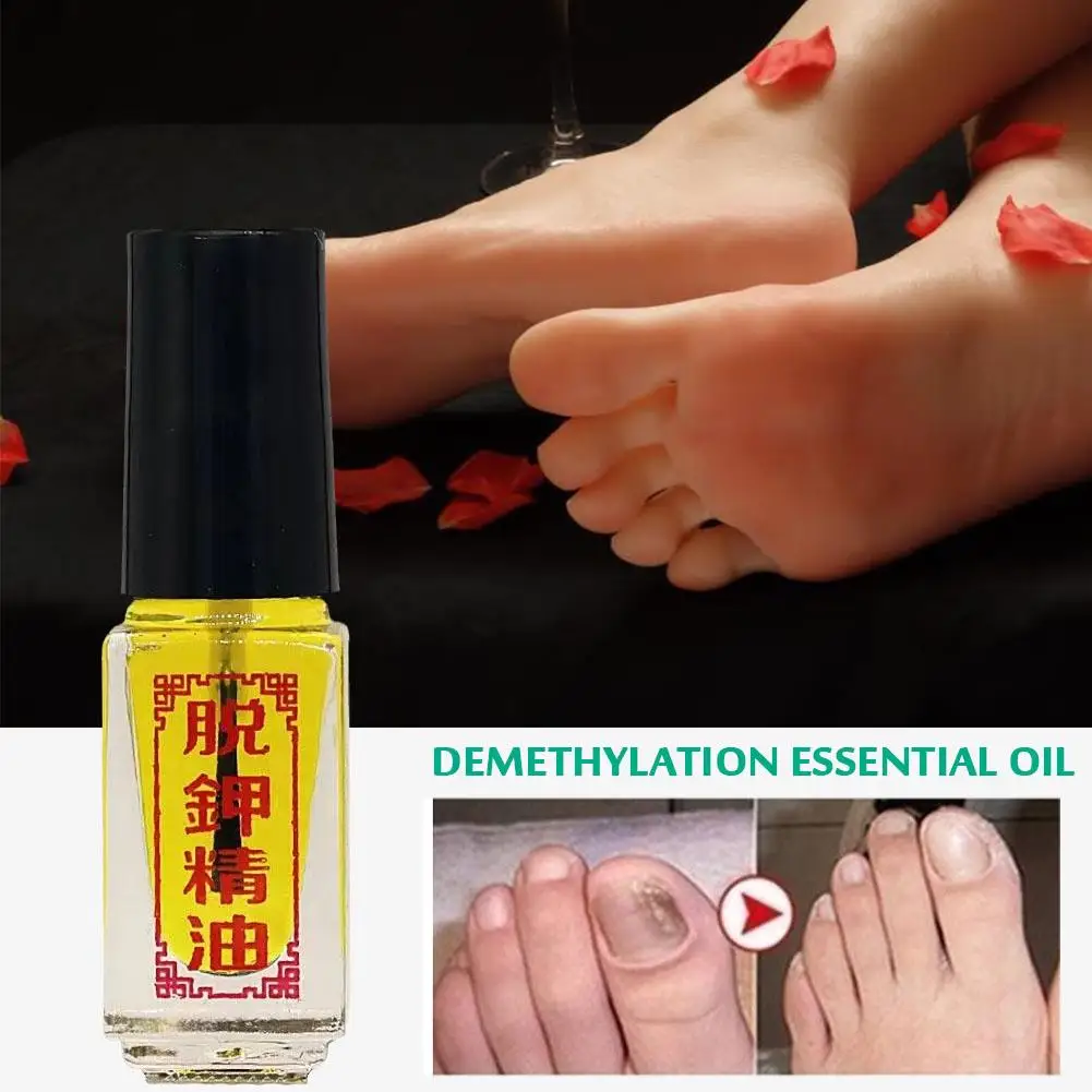 5ml Nail-Deleting Essential Oil Nail-Deleting Ointment Nail-Deleting Solution Enzymatic Solution Onychomycosis Solution External
