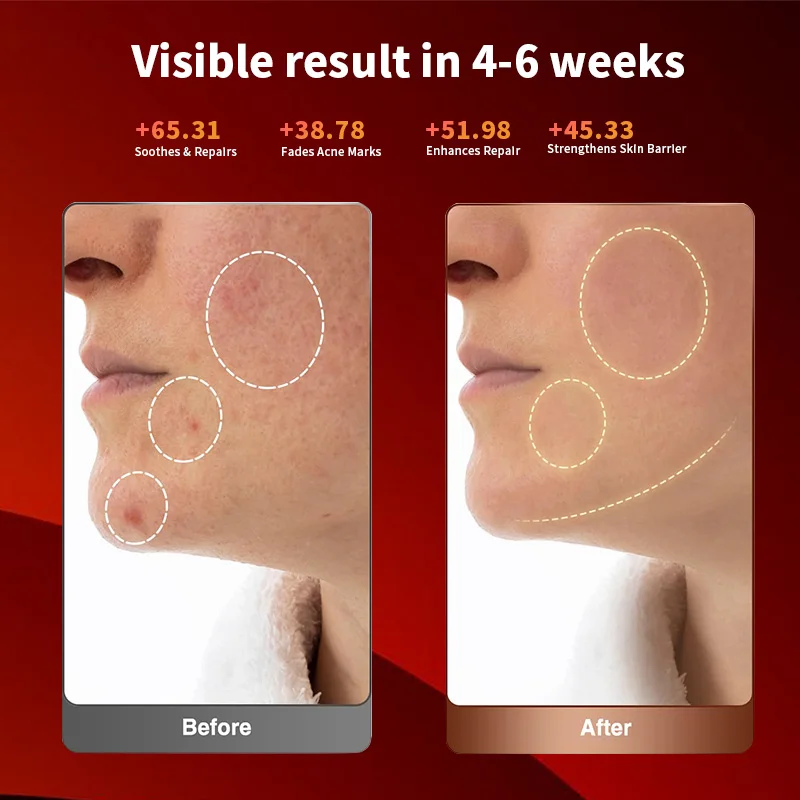 หน้ากากแสง LED Photon สำหรับกระตุ้นคอลลาเจน 630nm ยี่ห้อ Smart Library EYCO สำหรับใช้ในร้านเสริมสวยและที่บ้าน