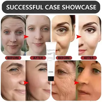 韓國緊緻視黃醇0.1抗皺霜 臉部修護緊緻輕盈蠟質保濕晚霜 20毫升 10 最佳銷售 韓式奶油 - №7