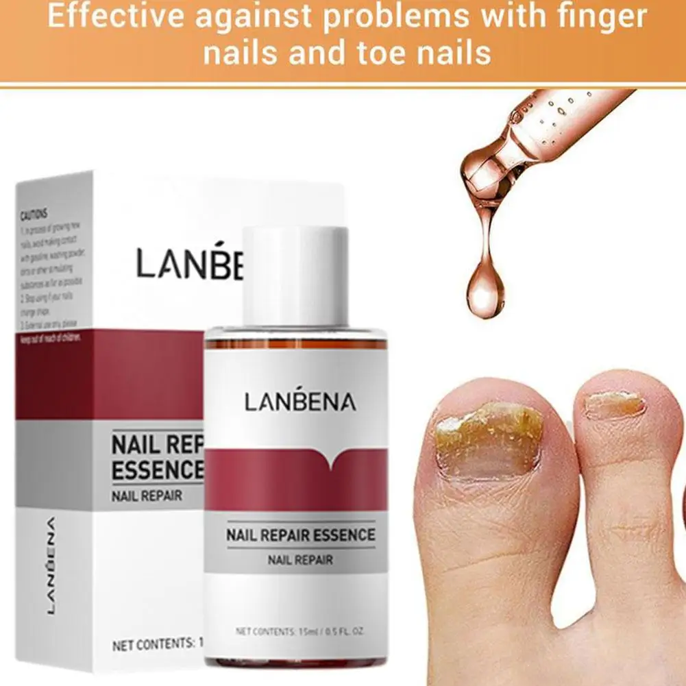 15 مللي LANBENA علاج الأظافر الفطرية قدم الرعاية جوهر إصلاح صحي الداحس فطار العدوى مصل أداة إزالة F F0Q6