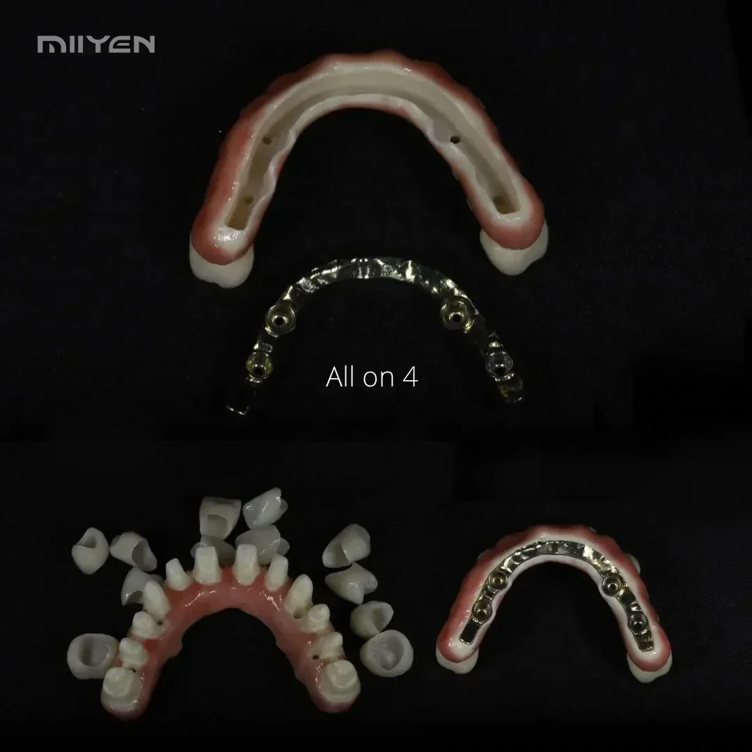 MIIYEN الجمالية الكل في واحد ثلاثية الأبعاد برو دن تال زركونيا كتلة متعدد الطبقات دن تال زركونيا كتلة دن تال زركونيا كتلة