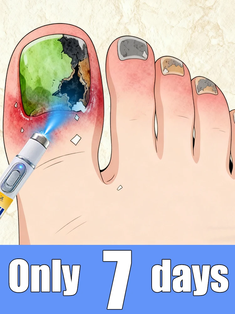 

Технологические изменения жизни - посмотрим на охихомикоз - посмотрим на задачи на ногти