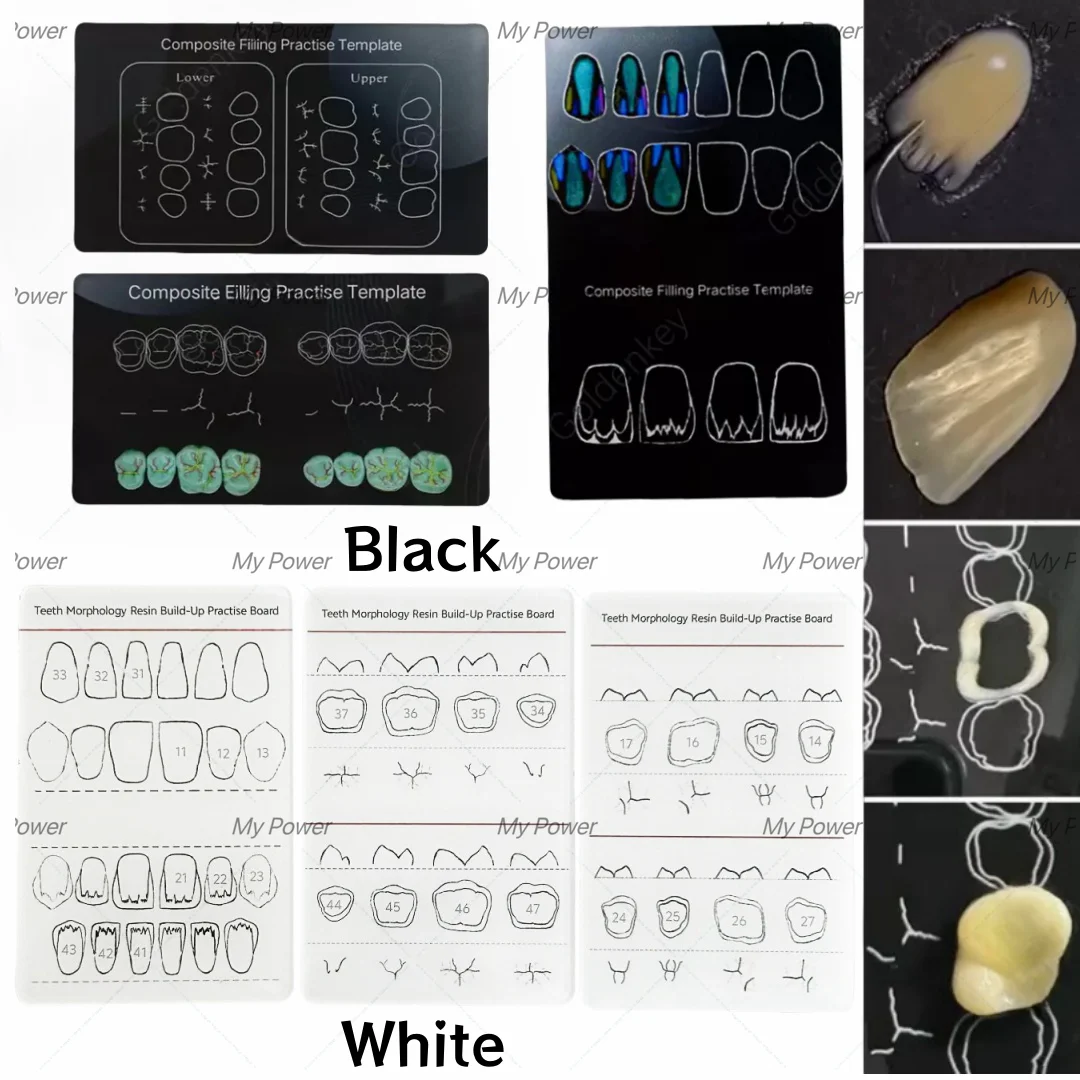 Template pengisi Resin komposit gigi, Model dokter gigi isi hitam/putih