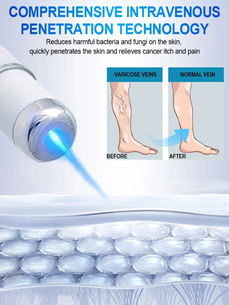 Laser Azul Cura Perna Veias