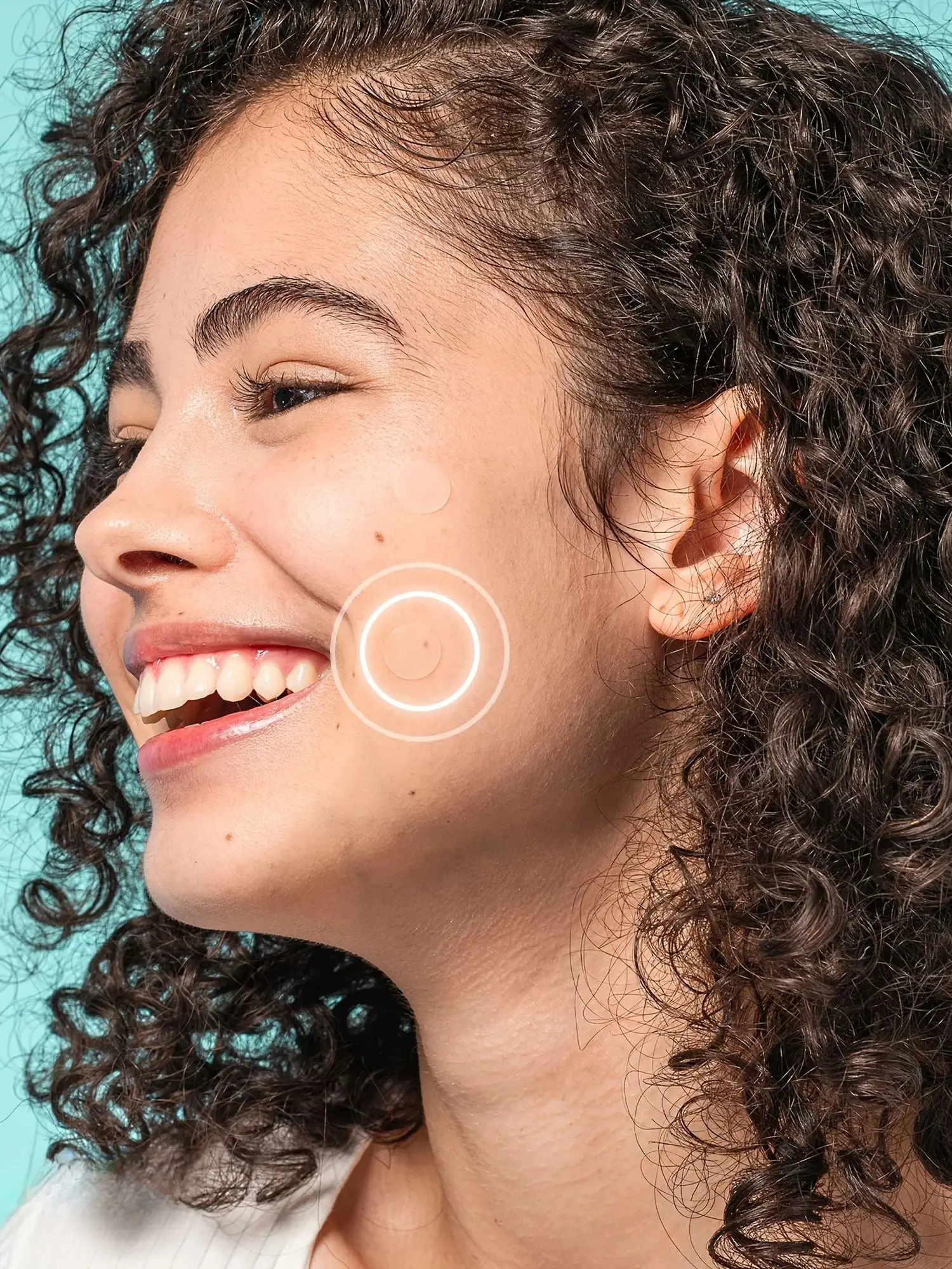 720 pieces of facial acne patches, concealer patches, pimples patches, ultra-thin invisible breathable hydrogel