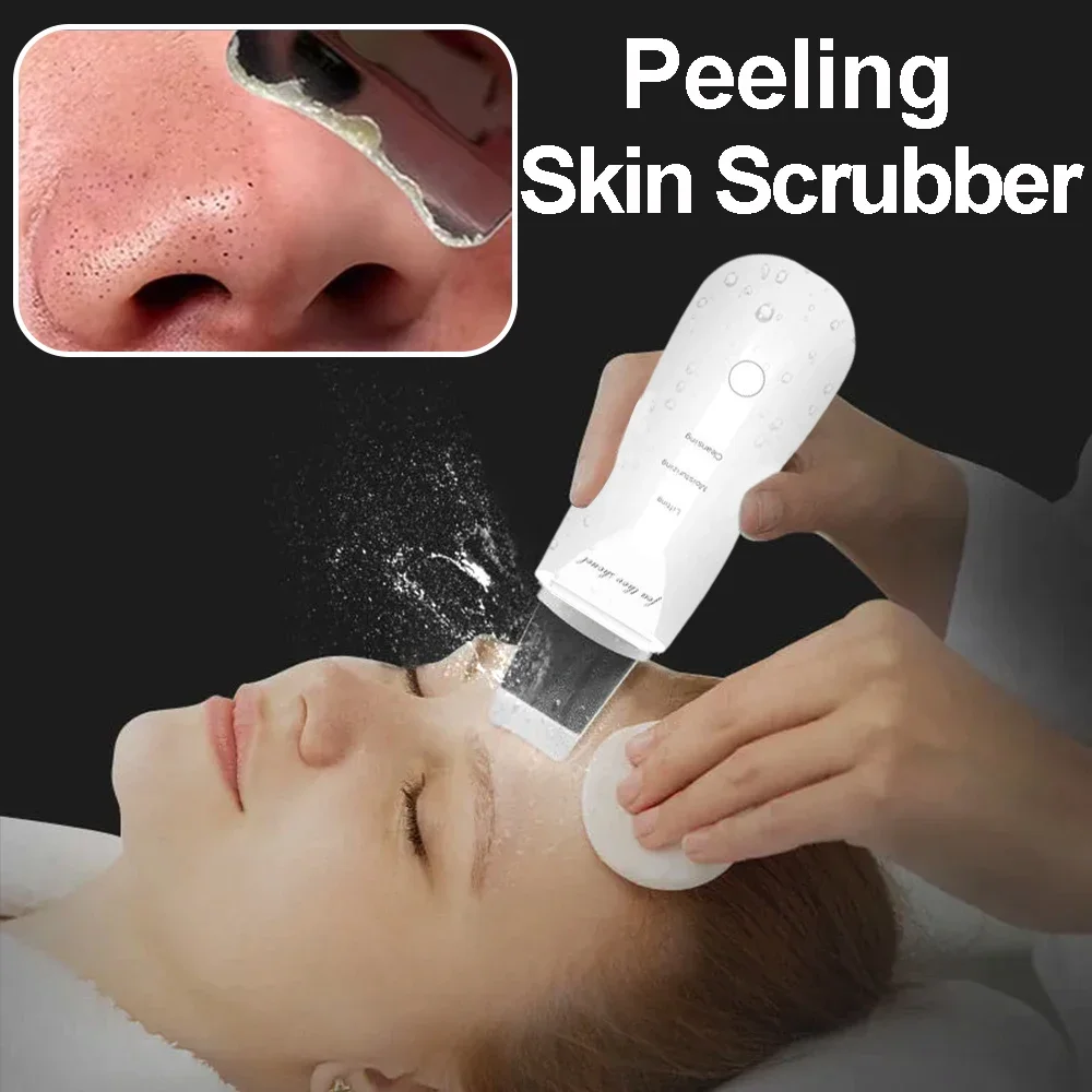 Raspador de pele elétrico peeling removedor de cravo ultra-sônico limpeza profunda do rosto levantamento acne poros espátula facial pá limpador