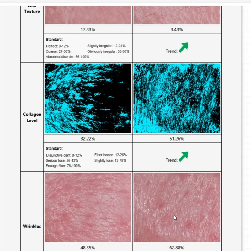 Hiszpański angielski estetyczny analizator ciała skóry i kwantowego rezonansu magnetycznego do diagnostyki skóry w salonie kosmetycznym