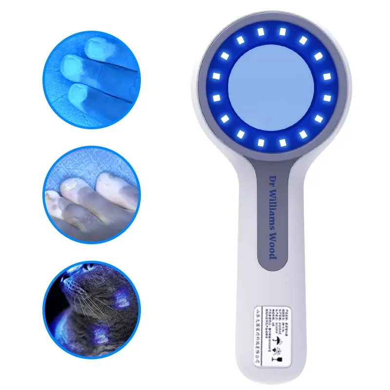 Woods Lamp For Vitiligo Skin Analyzer Fungus Detector Professional Facial Moss Tinea Magnifying Analyzer SPA Home Salon Use