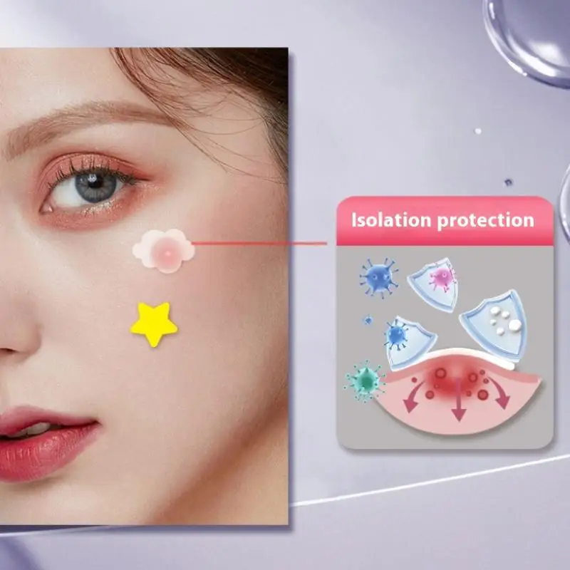 Press Edge Acne Patch PE Colorful Star Love Cloud Invisible Concealer Acne Patch Light Breathable Suction Liquid Acne Patch