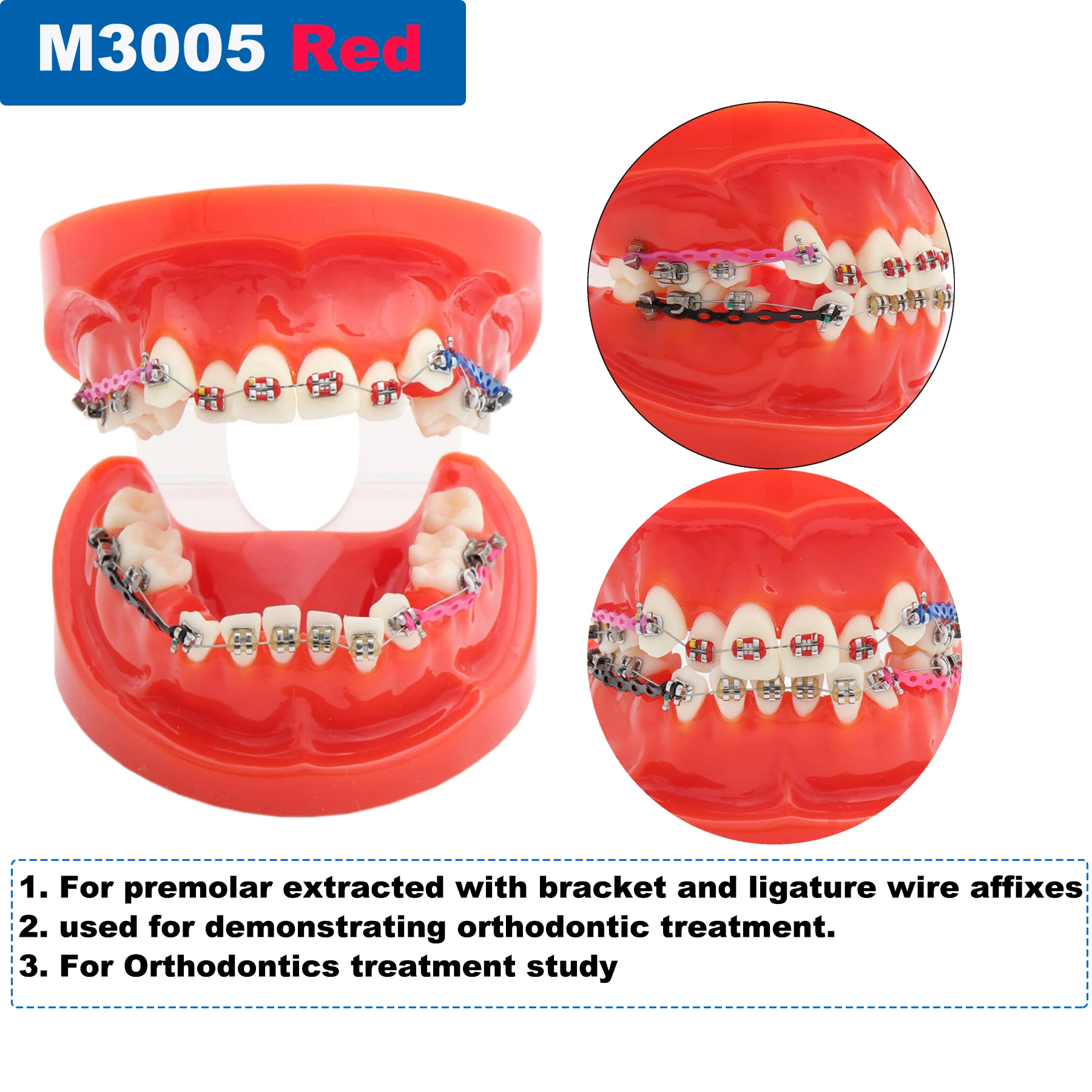 Standardowy Model dentystyczny Model zębów modelu patologicznego nauczania stomatologicznego ortodontycznego implantu przyzębia