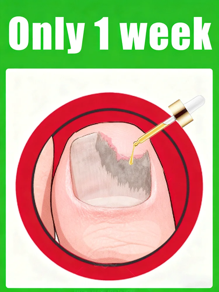 

2026 новых лазерных продуктов с быстрым проникновением