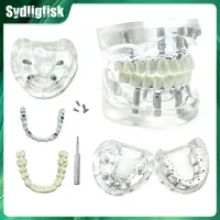 Modelo Dental, modelo de restauración de implantes, modelo de sobredentadura removible maxilar con 4 implantes, modelo educativo para estudiantes de dentista