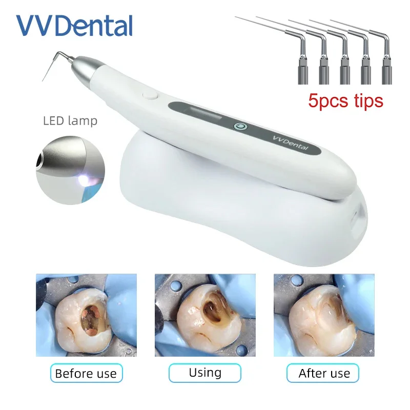 Dental LED Endo Ultra Activator Wireless Ultrasonic Irrigator Root Canal Ultrasonic Irrigator Washing Tooth with 5PCS Tips