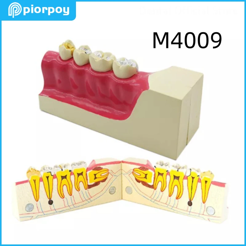 Dental Teaching Model Right Lower Posterior Tooth Tissue Decomposition Dentistry Student Molar Cross Studying Detachable Mold