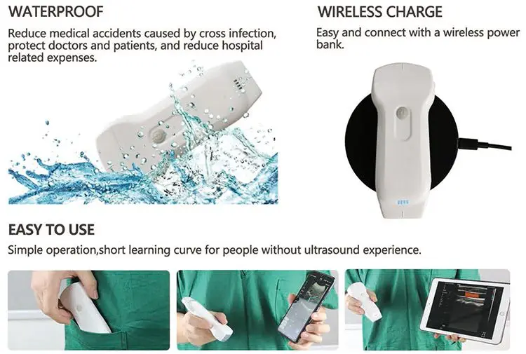 

3 в 1 Линейно-выпуклый двойной зонд Smartphone USB WIFI sonda de Ultrasound Portable PICC Wireless Ultrasound Probe