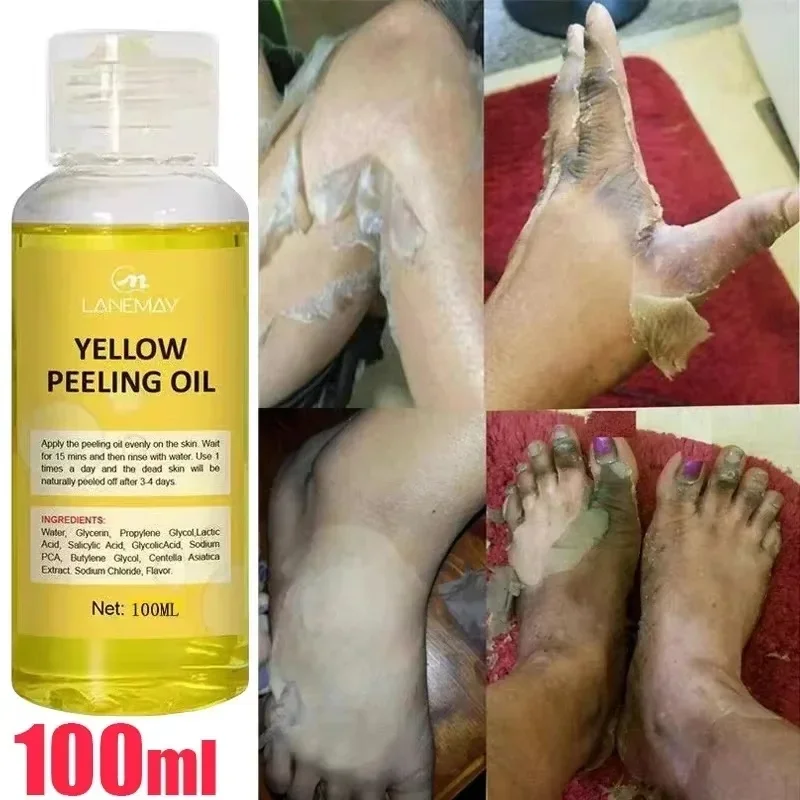 

Exfoliating Serum Care Dead Skin Peeling Oil Brighten Skin Bleaching Dark Remove Knee Arm Legs Melanin Body Whiten Scrub