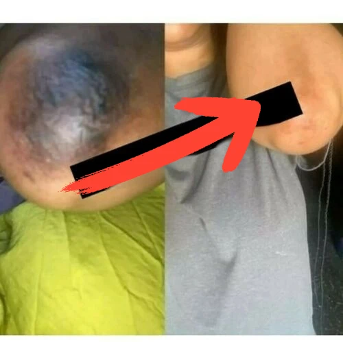 

PEELING Dark Knuckles ERASER Сыворотка для ног и локтей, DOES NOT HURT 30мл