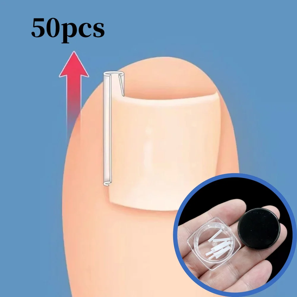 

50Pcs Straightening Clip Brace Pedicure Tool Ingrown Toenail Correction Tool Ingrown Toe Nail Treatment Elastic Patch Stickers