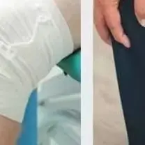 

CPM Lower Limb Fracture Post-Flexion Straightening Knee Joint Rehabilitation Trainer Electric Home Exercise Device