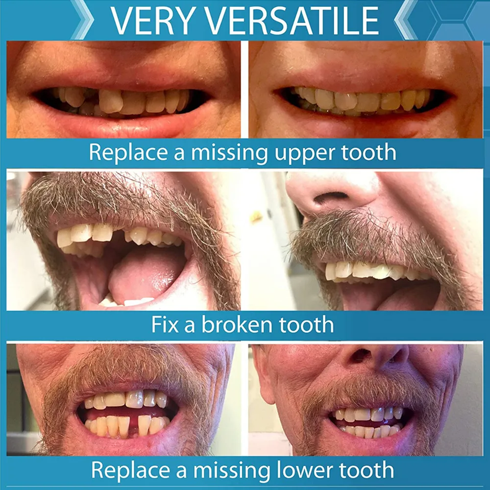 SowSmile nowa higiena jamy ustnej 4 odcienie kolory Snap on Instant tymczasowy uśmiech brakujące zęby wymiana fornirów zestaw sprzętu