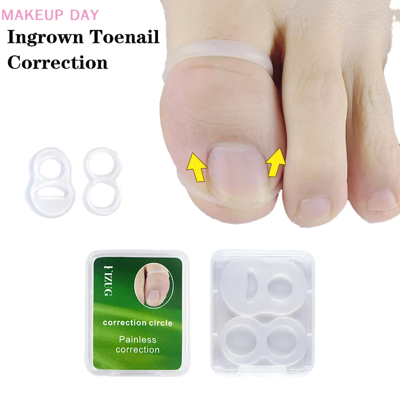 Ferramenta de correção unha ingrown, Correção unha, Ingrown Toe Nail, Endireitamento, Protector Brace, Pedicure Pés Cuidados Ferramentas