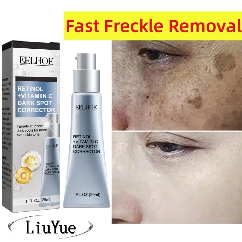 

Face Melasma Cream Brightening Dark Skin Emulsion Lightening Melanin Brighten Cream for Dull Skin Women Retinol Cream