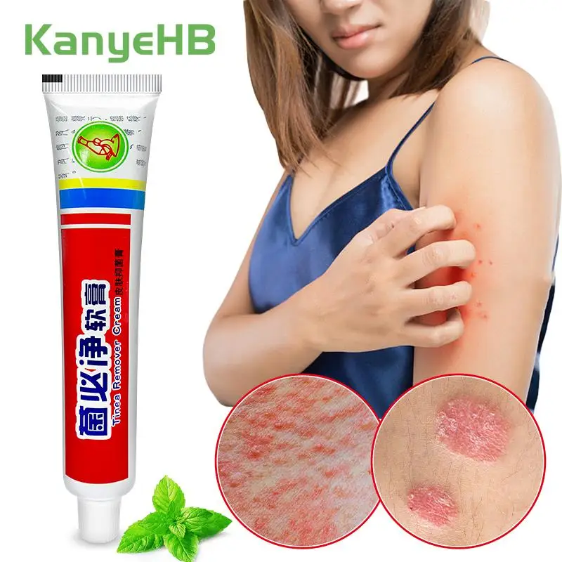 

1pcs Antifungal Anti-itch Skin Cream Psoriasis Inhibiting Fungi Treatment Ointment Rash Pityriasis Athlete's Foot Plaster S081