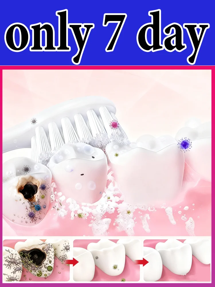 

Sᴄɪᴇɴᴛɪғɪᴄ Rᴇᴘᴀɪʀs Cᴀᴠɪᴛɪᴇs, Cʟᴇᴀɴs Pʟᴀᴏ̨ᴜᴇ, Wʜɪᴛᴇɴs Tᴇᴇᴛʜ