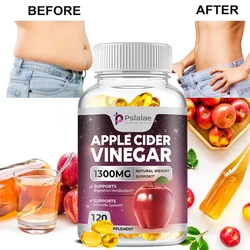 Apple Cider Vinegar Capsules - Weight Management, for Detoxification and Cleansing