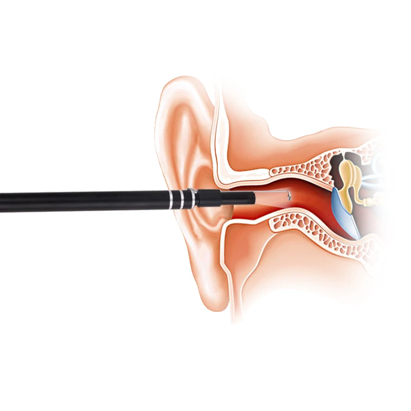 5.5mm 3in1 WIFI Earpick Endoscopio HD Earscope Cleaner per Android ISO PC Otoscopio per rimozione cerume