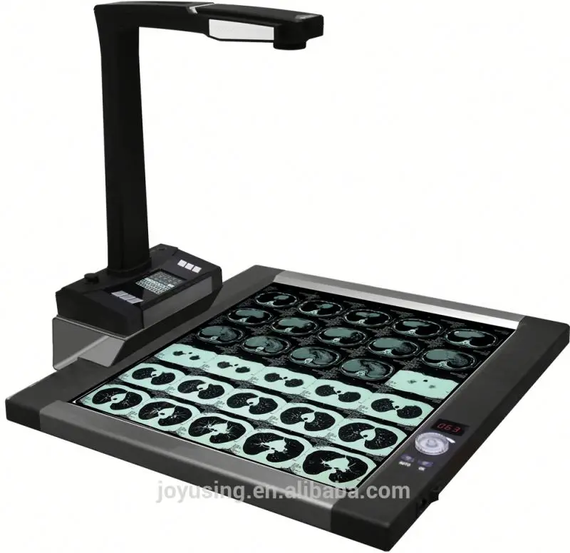 for CT160 X-Ray Film Scanner for Hospital and Clinic Diagnosis