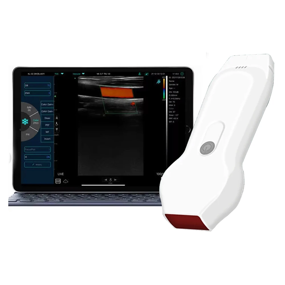 96 Elements 32 Channel Dual Frequency Ultrasound Probe Wireless WIFI Type Supports iOS Android Windows Multi-platform