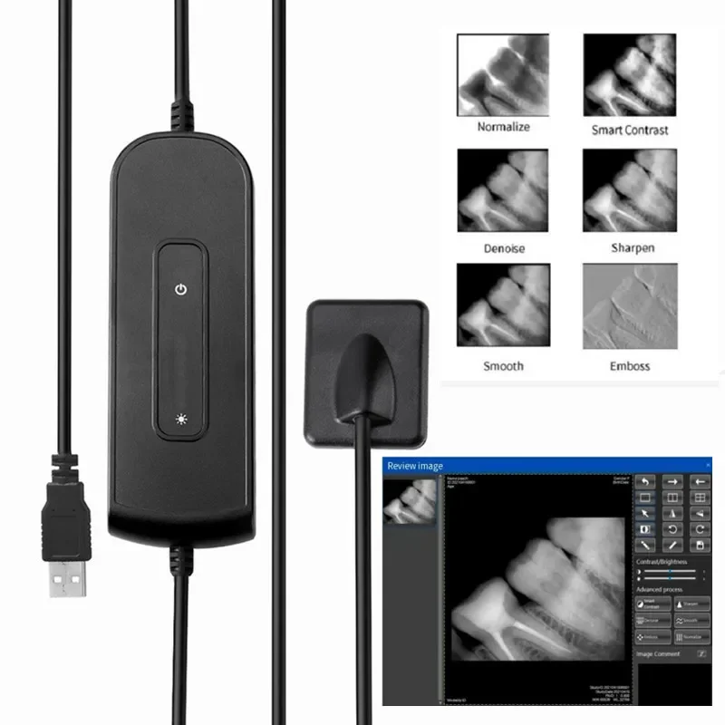 RVG X-Ray Sensor Small/Big Size High Resolution Intraoral Radiography Sensor   Imaging System for   Clinics