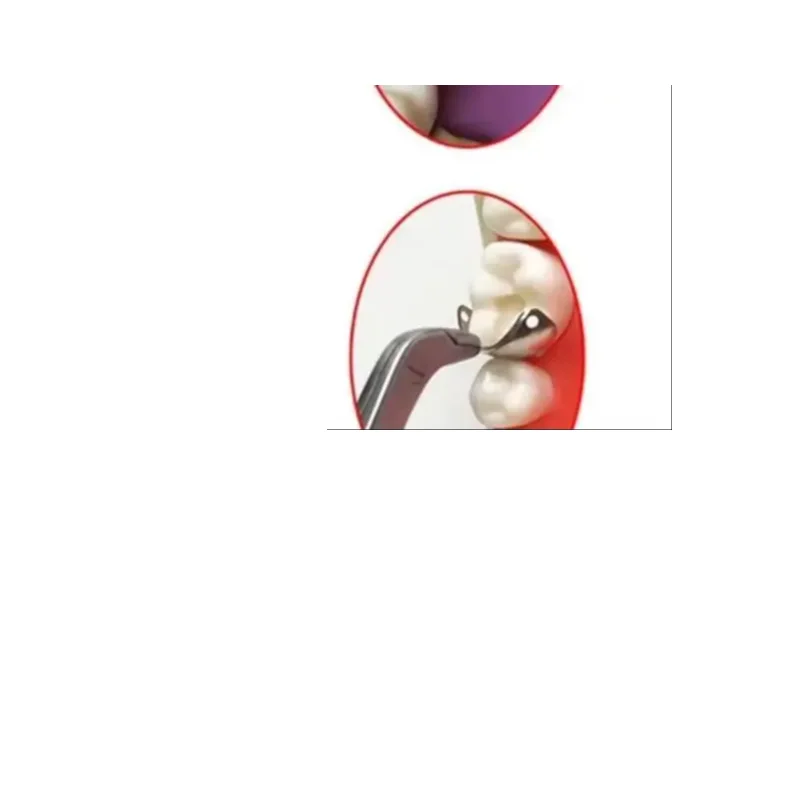 

50/100Pcs Box Dental Matrix Sectional Contoured Matrices Band Metal Rings Dental Materials Size 3.5/4.5/5.5/6.5mm