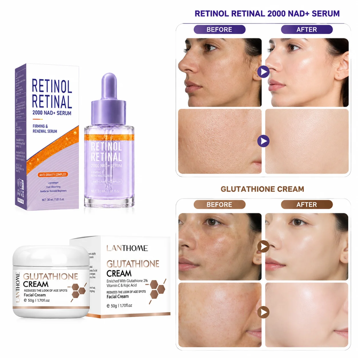 Sérum de Retinol Retinaldeído 2000 NAD+ + Creme de Glutationa 2%, Enriquecido com Vitamina C e Ácido Kójico, Firma, Suaviza e Uniformiza