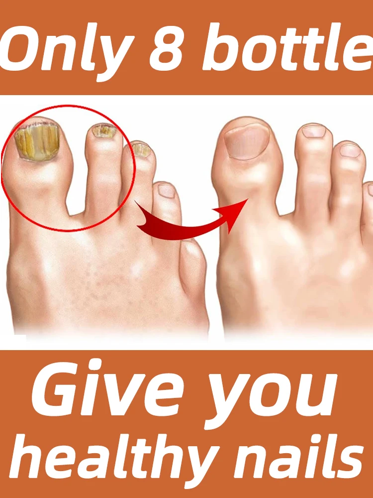 

Foot Nail Device Essence Repair Toe