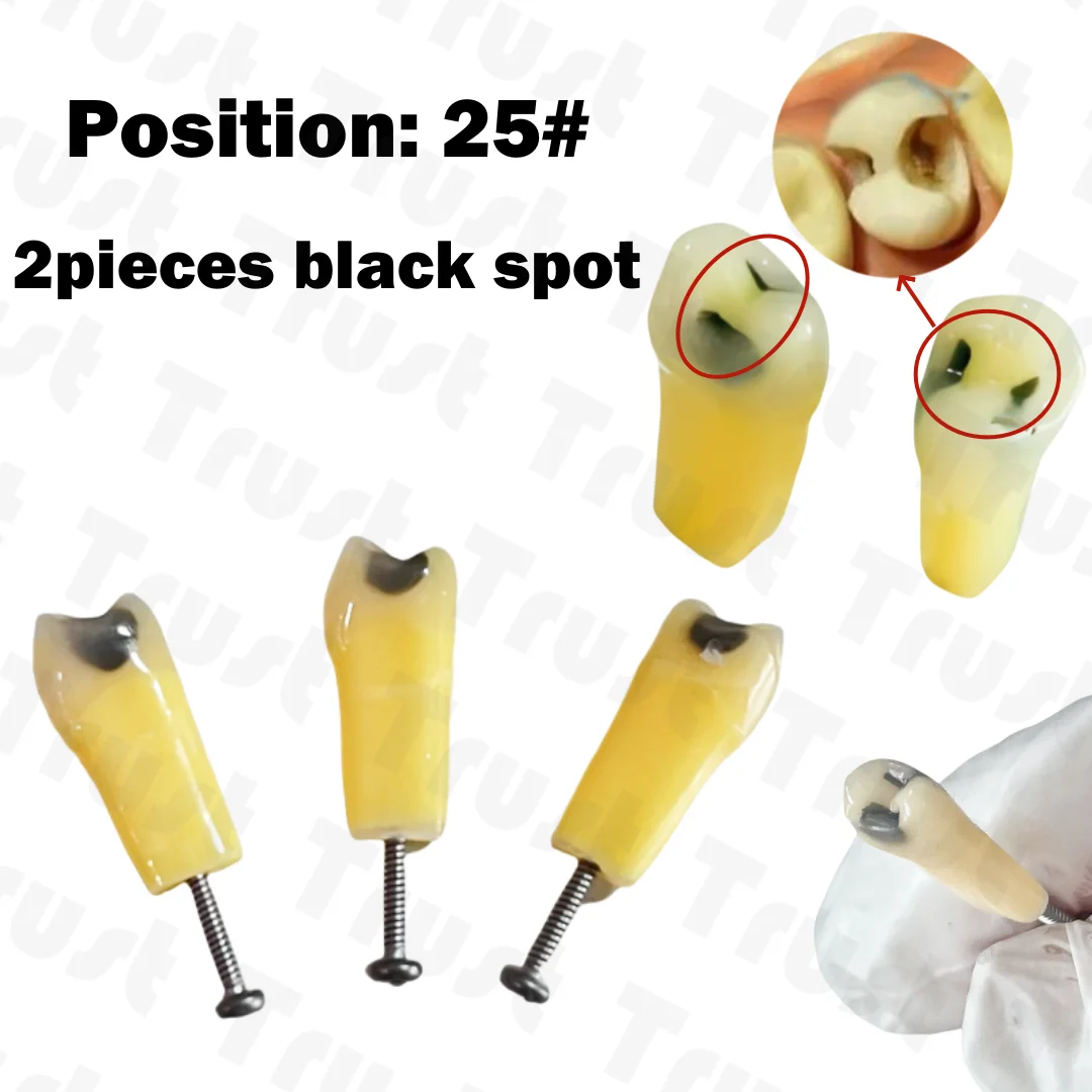 

New Fit Frasaco AG-3 ZKN Dental Cavity Teeth Model - Tooth Teaching Caries 25# Perfect for Dental Teaching and Training