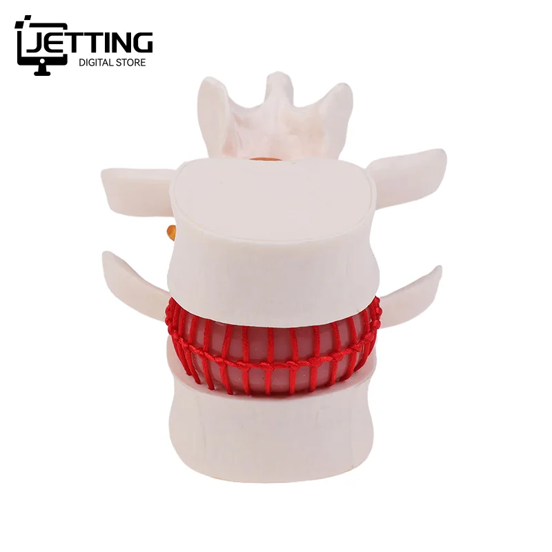 ✍ تشريح الإنسان الهيكل العظمي العمود الفقري قطني القرص فتق نموذج للتدريس الدماغ الجمجمة صدمة اللوازم المدرسية أداة طبية