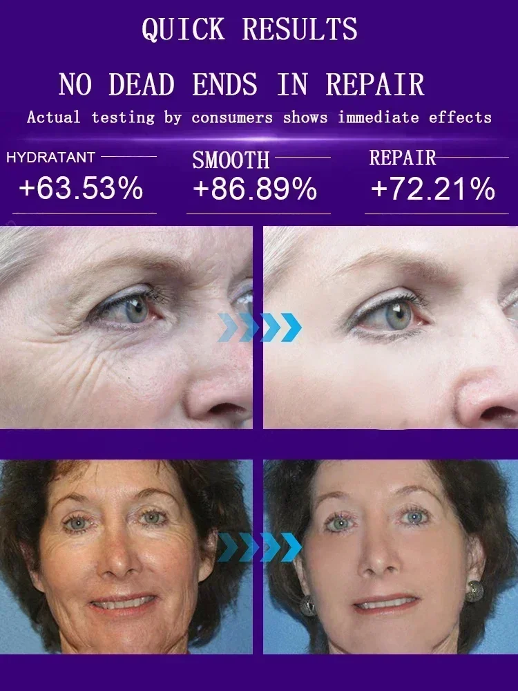 Instant Anti Wrinkle Aging Effect Remove Facial Wrinkles Fade Fine Lines Firming Tightening Face Skin Care Korea Cosmetic