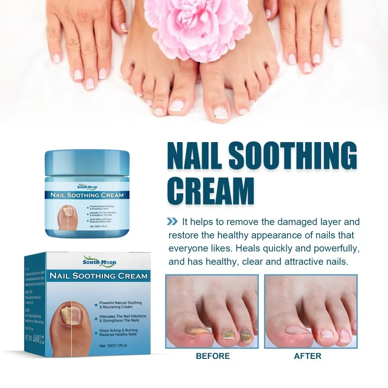 Nail Soothing Cream Repair Onychomycosis Treat Damaged Nails Thickening Nail Type Nourishing Essence Health Beauty Care Cream