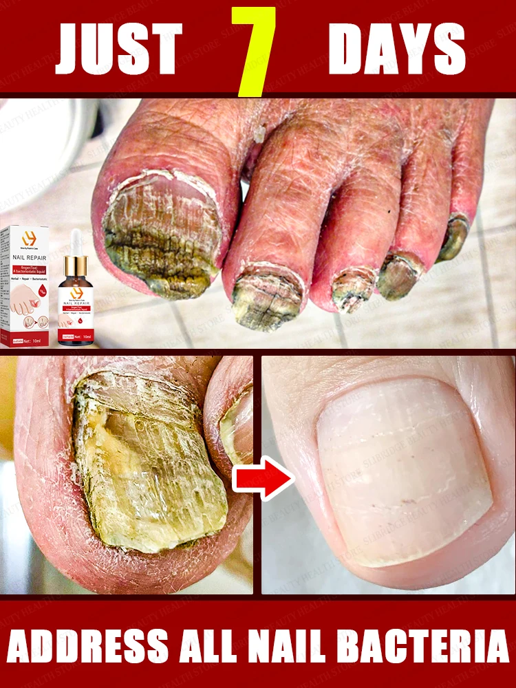 

Solve all nails problem