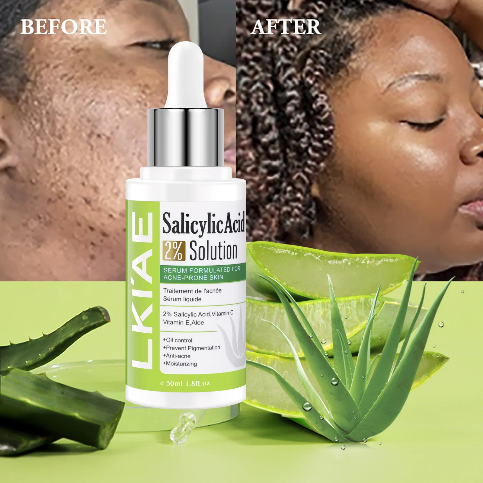 LKIAE Aloe Vera Lightening Face Serum, Idea Facial Essence to Anti Acne, with Vitamin C, Vitamin E, Moisturizing, Clean Skin