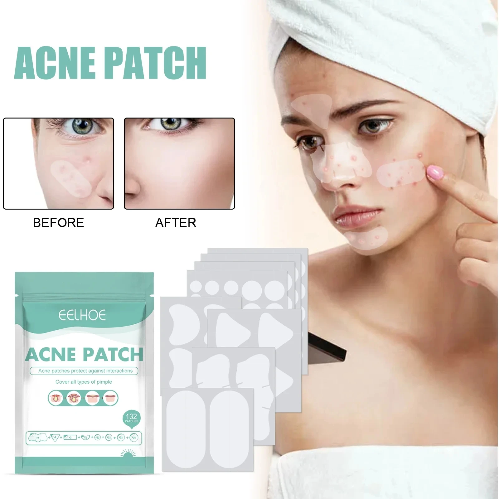 132 Stuks Acne Puistje Patches Stickers Acne Spot Onzichtbare Concealer Acne Patch Smet Gezichtsmasker Hydrocolloid Comedondrukker