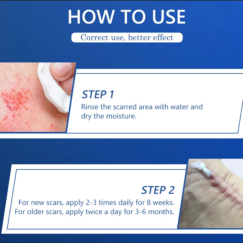 Herbal Scar Removal Cream Treatment Burn Surgical Scar Stretch Marks Acne Spots Repair Pigmentation Body Smooth Beauty Skin Care