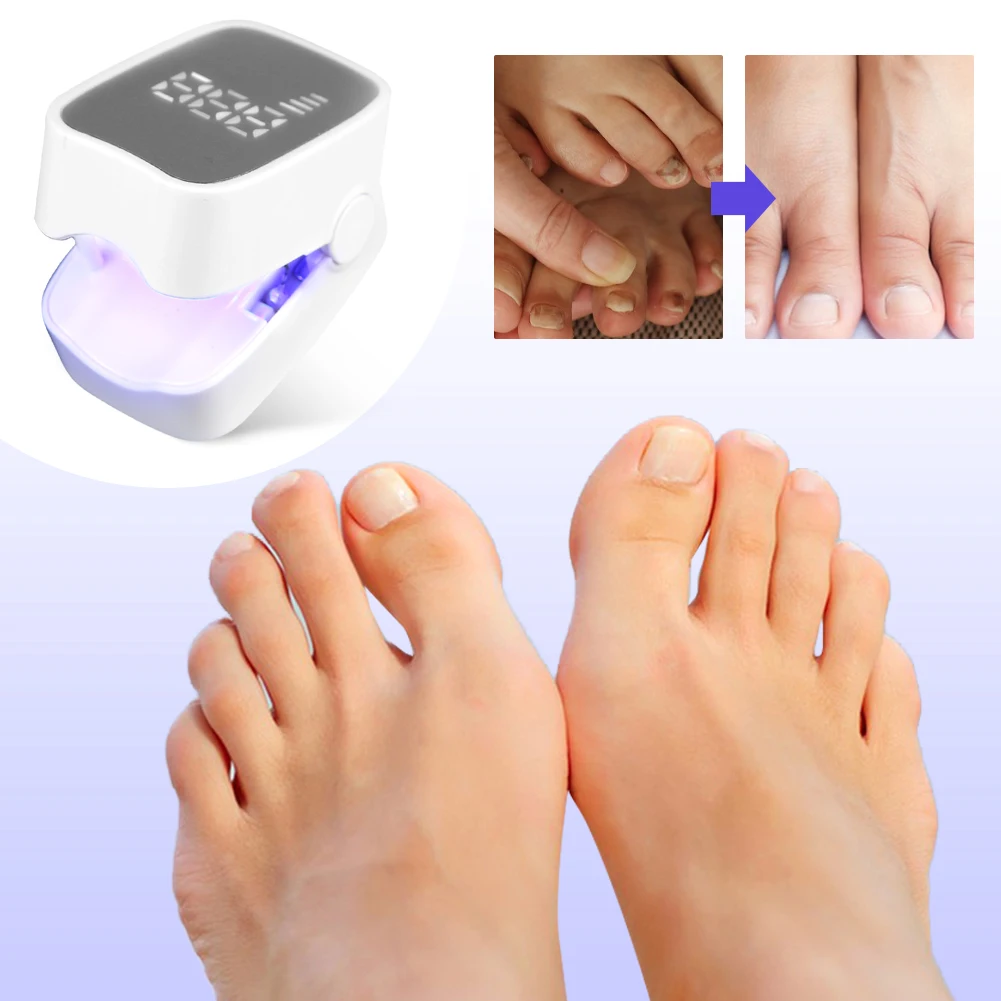 

Легкое устройство для очистки грибка ногтей, портативная машина для очистки грибка ногтей на ногах, автоматическое выключение для обесцвеченного утолщенного ногтя на ногах