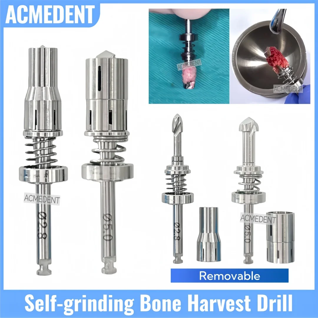 

Стоматологическая GBR самошлифовальная пружинная дрель для урожая костей Bonesier, автогенные трепанские боры, порошковая коллекция, дрель, имплантат, подходит для Jeil