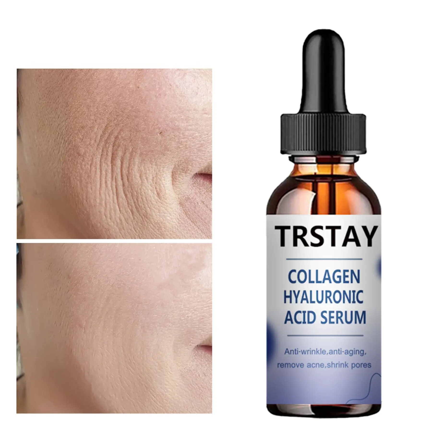 Face Skin Care Collagen Hyaluronic Acid Serum Retinol Vitamin Anti-Aging Wrinkle Moisturizing Whitening Shrink Pores