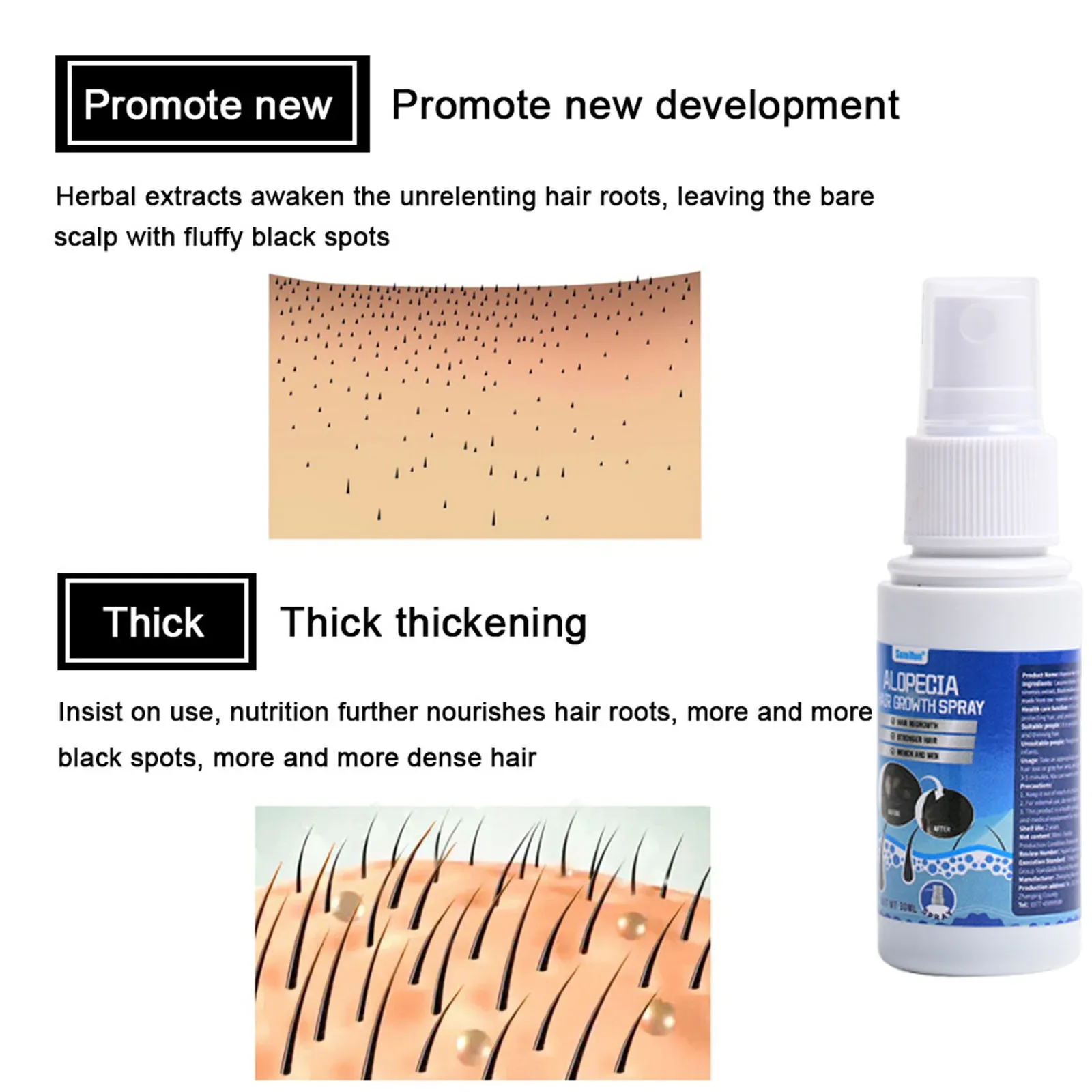 Snelle Haargroei Serum Spray Anti Haaruitval Voorkomen Kaalheid Hoofdhuid Behandeling Reparatie Wortels Schoonheid Gezondheid Haarverzorging Voor Mannen Vrouwen